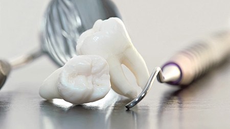 A closeup of wisdom teeth next to dental tools