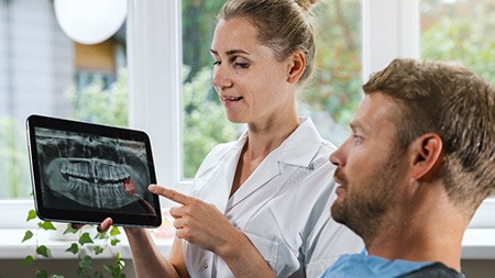 A smiling woman holding an extracted wisdom tooth while giving a thumbs up